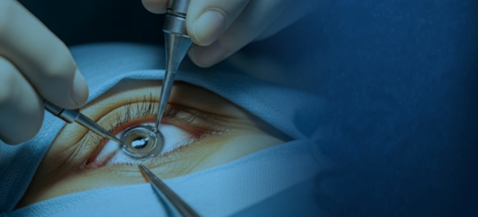 Residentado Médico en Oftalmología